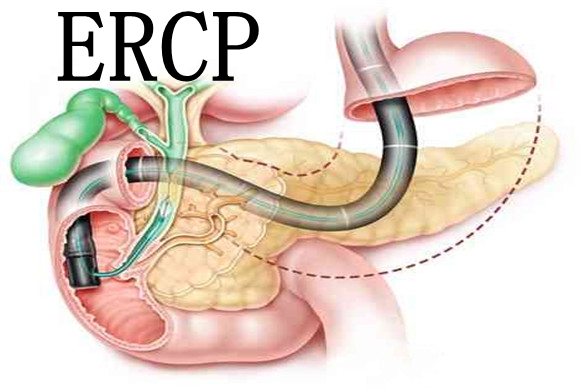 ERCP機(jī)房輻射防護(hù)建設(shè)要求與注意事項(xiàng) ERCP機(jī)房輻射防護(hù)建設(shè)要求與注意事項(xiàng)